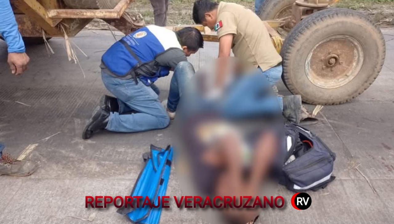 ¡Tragedia en Carlos A. Carrillo! Joven de 20 años pierde el pie en accidente con carreta cañera