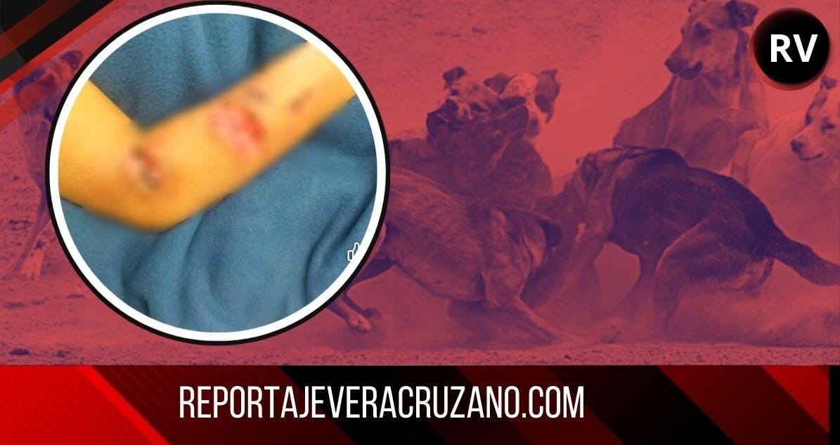 Jauría de perros ataca a menor en Tlapacoyan; Óscar se dirigía a trabajar al corte de café