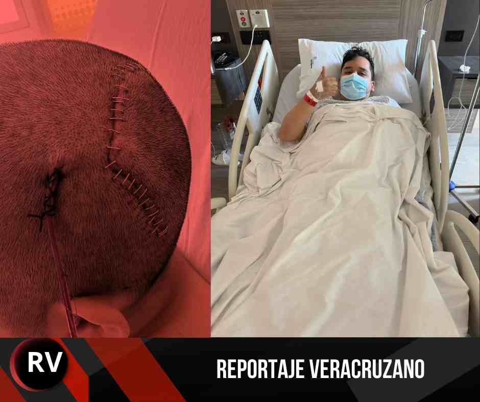 Joven orizabeño lucha contra tumor cerebral: David Uriel solicita apoyo para costear tratamiento