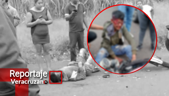 Choque entre motociclistas en carretera Omealca–Cuichapa deja dos lesionados de gravedad